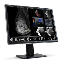 Medizinscher Monitor zeigt Mammographie- und Ultraschallbilder zur Diagnostik an.