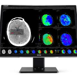 Monitor mit medizinischen Bilddaten, darunter CT-Bilder und farbkodierte Auswertungen des Gehirns.