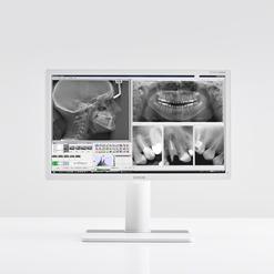Monitor mit Röntgenbildern des Gebisses und zahnmedizinischer Software auf einem neutralen Hintergrund.
