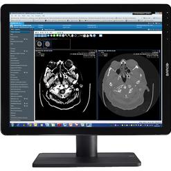 CT-Scans des Schädels angezeigt auf einem medizinischen Monitor mit Benutzeroberfläche links und rechts.
