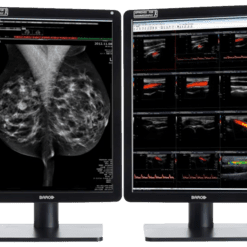 Zwei medizinische Monitore zeigen Mammographie- und Ultraschallbilder zur Diagnostik.