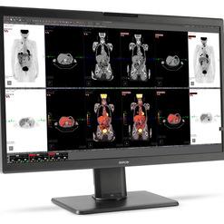 Monitor mit mehreren CT-Bildern von menschlichen Körpern in verschiedenen Ansichten und Farbcodes zur Analyse.