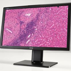 Monitor mit mikroskopischer Ansicht von pinkem Gewebe, zeigt Zellstrukturen und Blutgefäße.