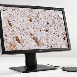 Monitor zeigt ein mikroskopisches Bild von Gewebeproben mit braunen und blauen Farbtönungen auf heller Fläche.