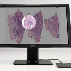 Monitor zeigt digitale histologische Aufnahmen mit Zoom auf zellulären Strukturen und einem Handsteuergerät daneben.