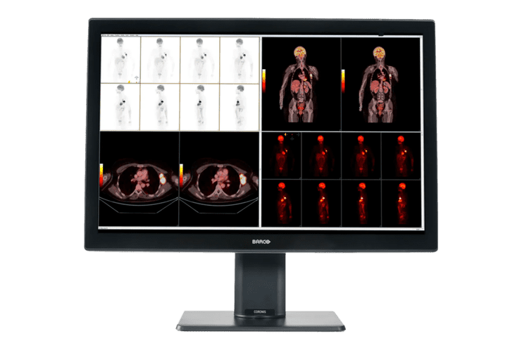 Monitor mit verschiedenen medizinischen Bildgebungen, einschließlich CT-Scans und anatomischen Darstellungen von Körperteilen.