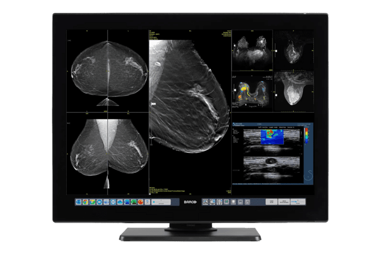 Medizinischer Monitor zeigt verschiedene bildgebende Aufnahmen der Brust, einschließlich Mammographie und Ultraschall.