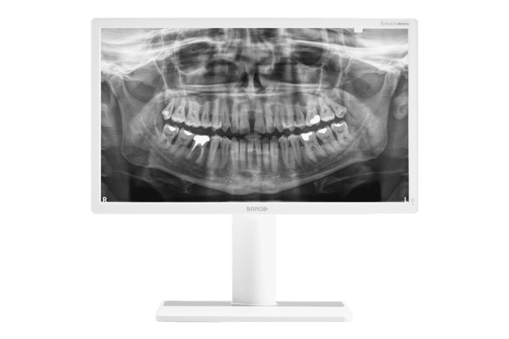 Röntgenaufnahme eines Kiefers mit sichtbaren Zähnen auf einem weißen Monitor.