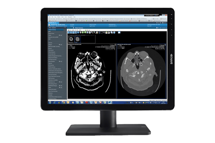 Computerbildschirm mit medizinischen Bildgebungen, der CT-Scans des Schädels zeigt.