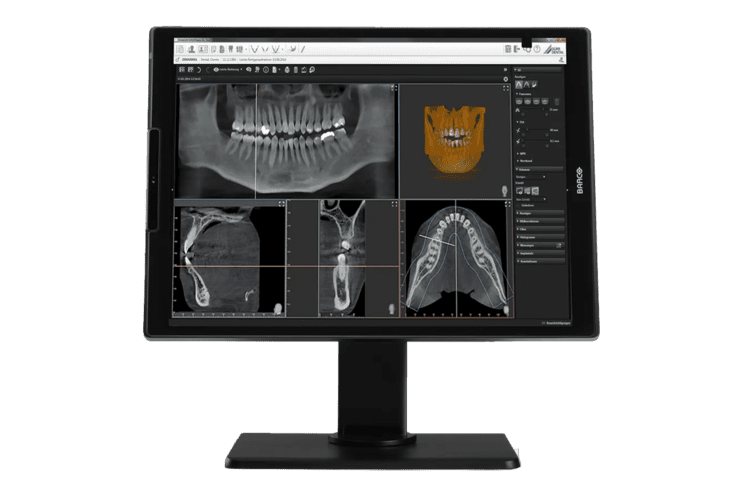 Monitor mit mehreren zahnmedizinischen Röntgenbildern und 3D-Darstellungen der Kiefer und Zähne.