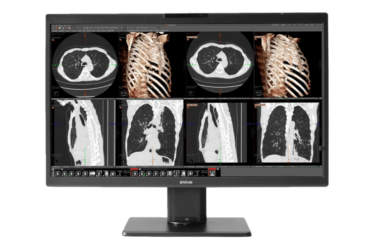 Monitor mit medizinischen Bildgebungen: mehrere Röntgen- und CT-Scans der Lungen und Rippen aufgeteilt in sechs Ansichten.