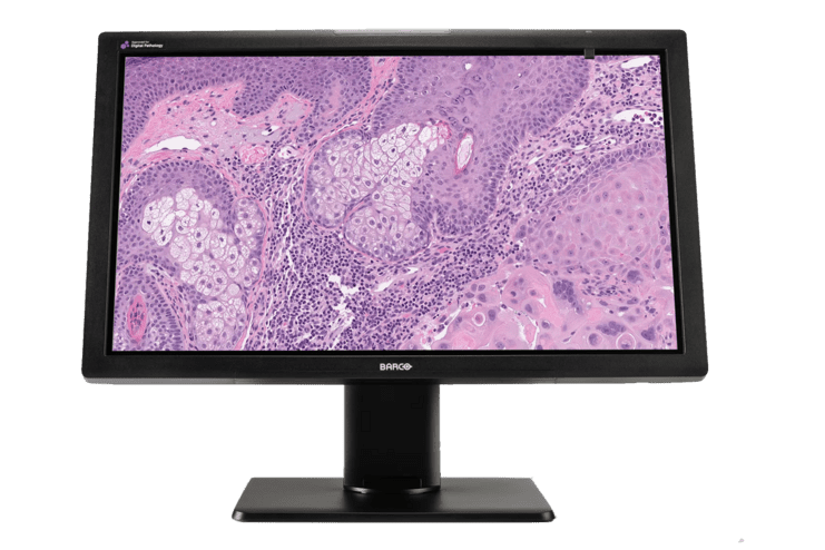 Monitor zeigt eine mikroskopische Aufnahme von Gewebe mit lila und rosa Farbtönen.