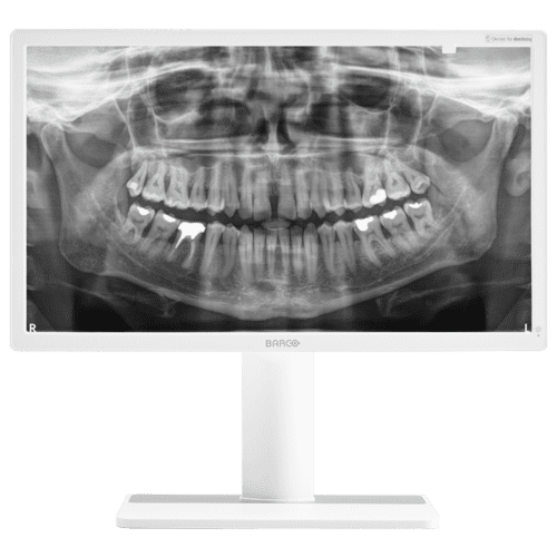 R&ouml;ntgenaufnahme eines Kiefers mit sichtbaren Z&auml;hnen auf einem wei&szlig;en Monitor.