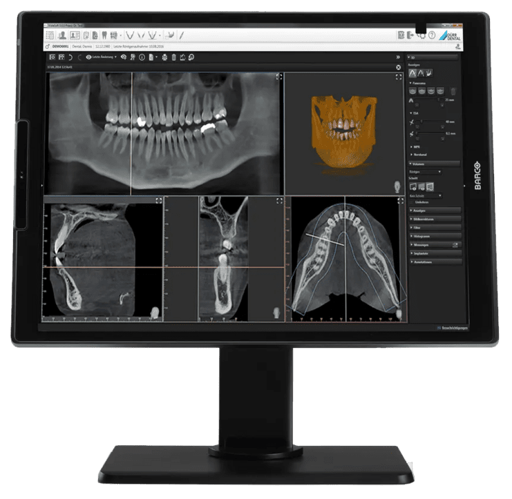Monitor mit verschiedenen zahnmedizinischen Röntgenbildern und 3D-Darstellungen des Schädels und der Zähne.