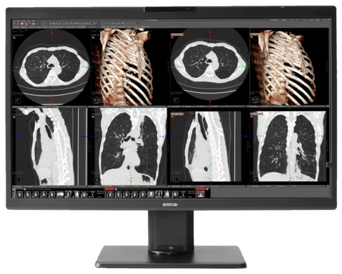 Monitor mit mehreren R&ouml;ntgenbildern des Thorax, einschlie&szlig;lich Skelett- und Lungenansichten.