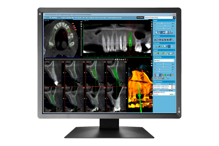 Bildschirm mit dentalen R&ouml;ntgenbildern, einschlie&szlig;lich 3D-Darstellungen und diagnostischen Werkzeugen auf einer Benutzeroberfl&auml;che.