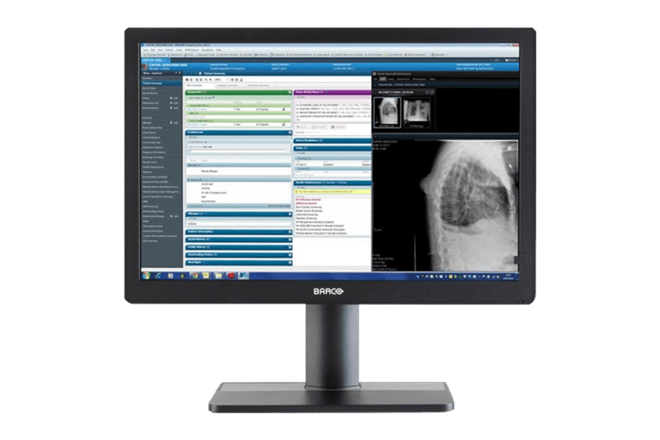 Monitor mit medizinischer Software, zeigt R&ouml;ntgenbilder zusammen mit Patientendaten auf dem Bildschirm.