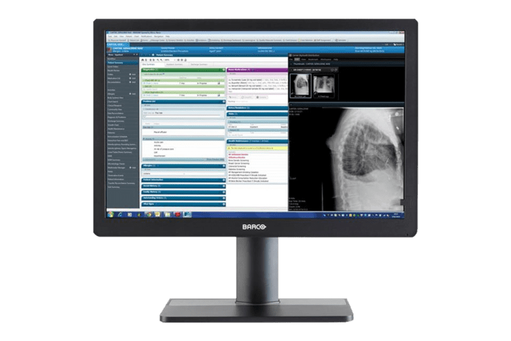 Monitor mit medizinischer Software, zeigt R&ouml;ntgenaufnahme und Patientendaten auf der linken Bildschirmh&auml;lfte an.