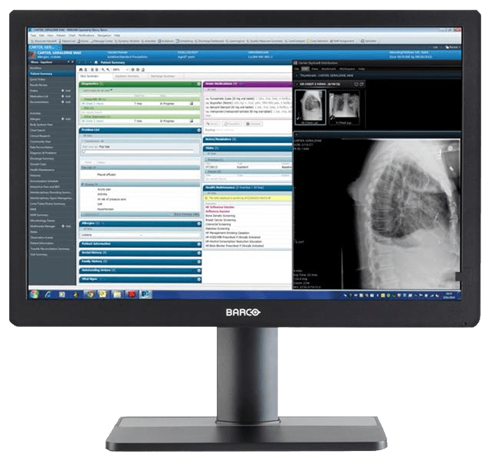 Monitor zeigt medizinische Software mit Patientendaten und einer Röntgenaufnahme des Brustkorbs auf dem Bildschirm.